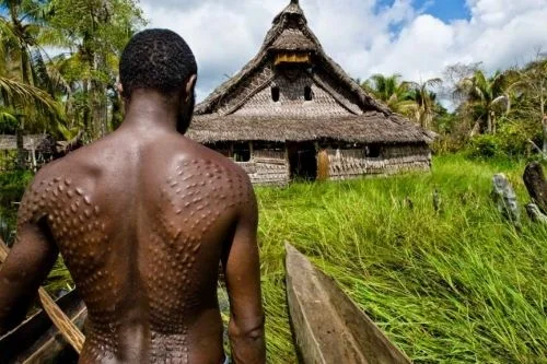 Шрамирование – история экстремального увлечения